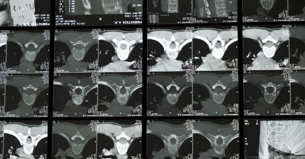 Posture Perfect How Pulse Align Tackles Scoliosis For A Balanced Life рџњ рџ є