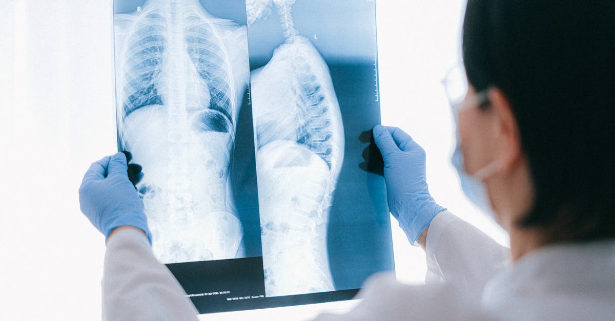 discover effective solutions and insights for managing thoracic spine pain. learn about causes, symptoms, and treatment options to improve your quality of life.