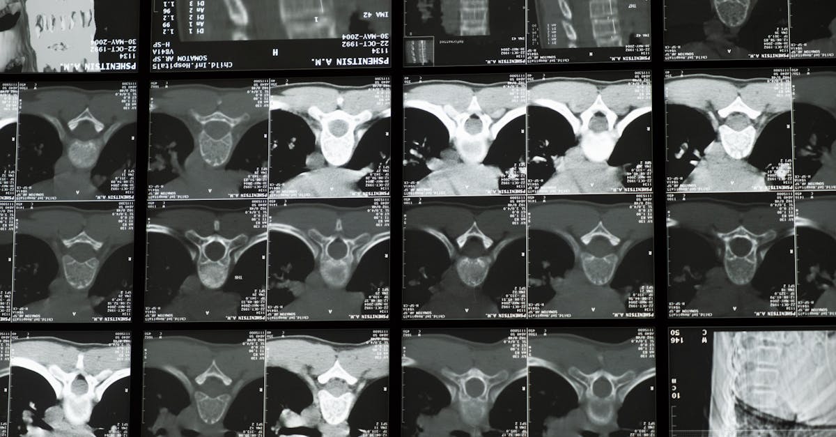 Douleurs thoraciques : Soulagement ciblé grâce à l'approche équilibrée de Pulse Align