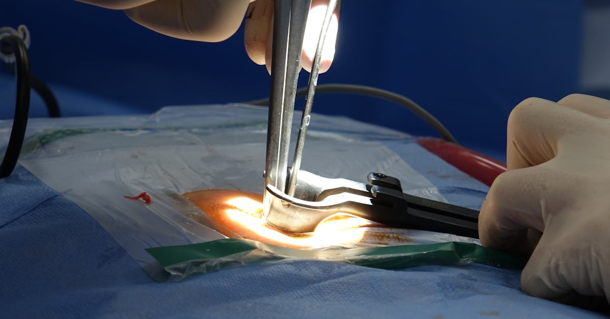 La importancia del fortalecimiento del core. El fortalecimiento del core es fundamental para quienes padecen una hernia discal. Realizar inclinaciones pélvicas y ejercicios similares para el tronco no solo favorece la alineación de la columna, sino que también ayuda a aliviar las molestias asociadas con el alivio del dolor de ciática.