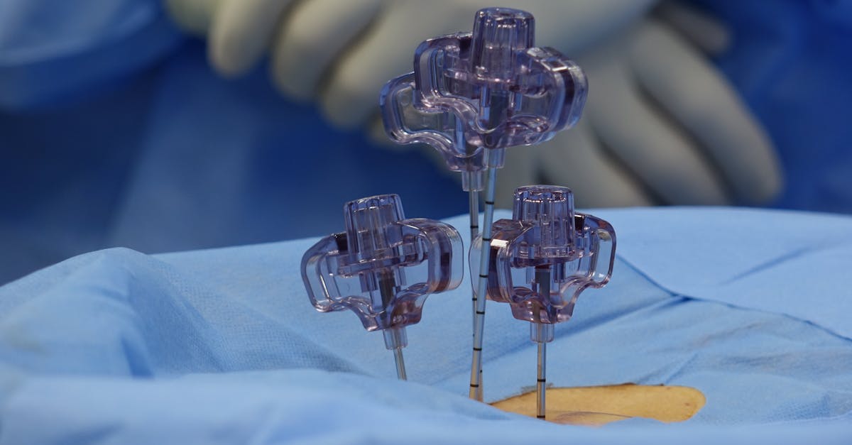 Cómo adaptarse a una hernia discal: Pulse Align puede ayudarle