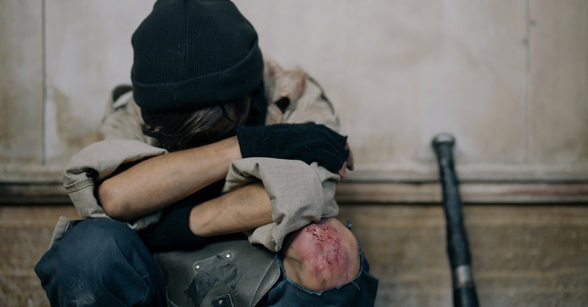 Rotator Cuff Injury Concerns? Trust Pulse Align’s Supportive Routines 2 learn about rotator cuff injury, including common causes, symptoms, treatment options, and recovery tips to help you regain shoulder strength and mobility.